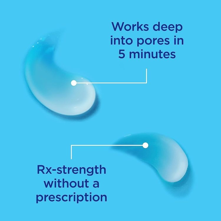 디페린 겔 0.1% 아다팔렌 여드름 연고 15g
